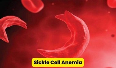 एनीमिया मुक्त भारत अभियान में छत्‍तीसगढ़ ने मारी बाजी, देशभर में अव्वल