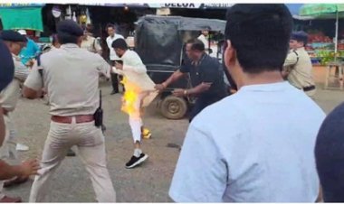 पुतला जलाते कांग्रेस के जिला अध्यक्ष वासुदेव आए आग की चपेट में, झुलसे