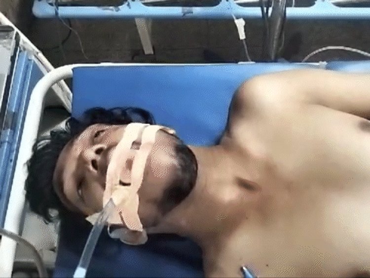 इंदौर में पत्नी,सास-ससुर ने तोड़ी गर्दन की हड्‌डी:दो साल पहले लव मैरिज की,पत्नी को लेने मायके गया तो हुआ विवाद, 4 पर केस दर्ज