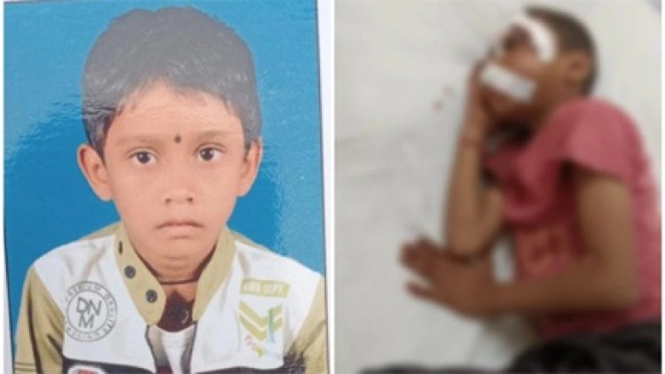 6 साल के बच्चे को बेरहमी से पीटा, आंख में डाला गोंद, अस्पताल में जिंदगी की जंग लड़ रहा मासूम