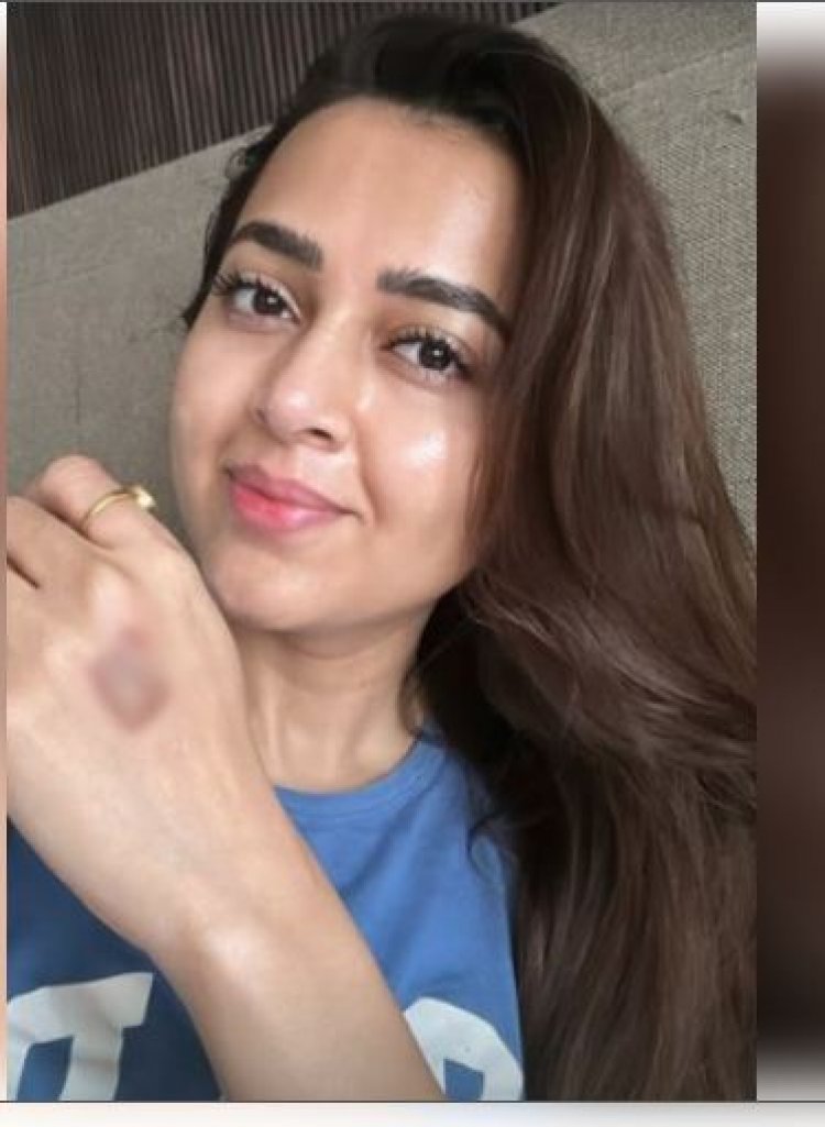 'सेलिब्रिटी मास्टरशेफ' के सेट पर घायल हुईं तेजस्वी प्रकाश, सोशल मीडिया पर प्रशंसकों को दी जानकारी