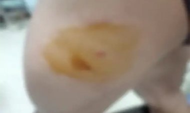 जेल में दोस्त मिलने नहीं आया, नाराज होकर मारा कैंची