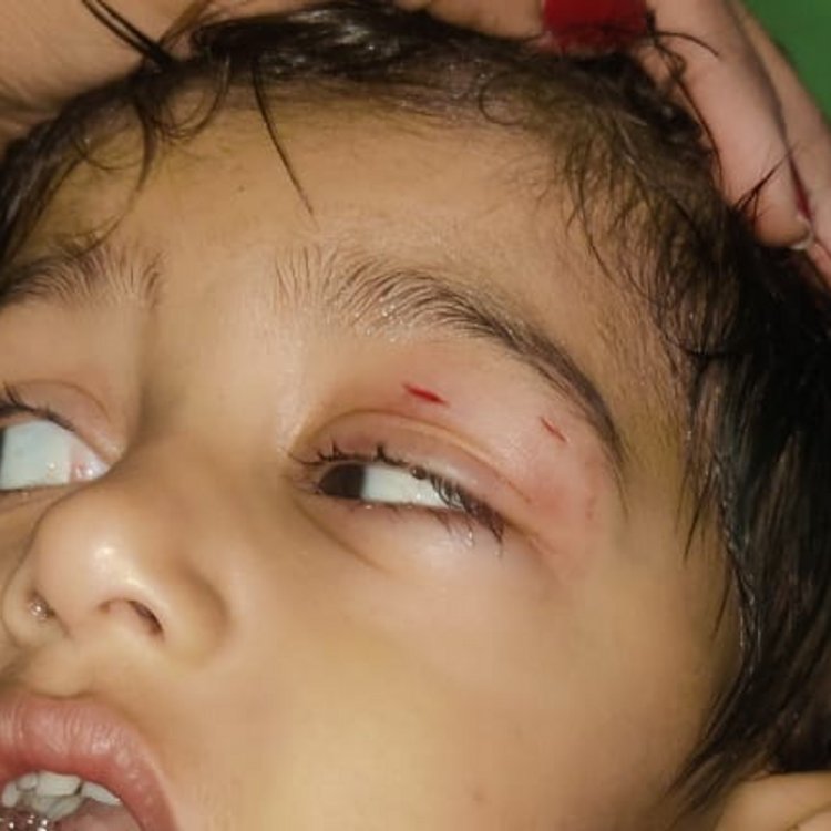 नर्मदापुरम के कमिश्नर कॉलोनी में स्ट्रीट डॉग का आतंक:पिता-पुत्र 4 को किया जख्मी, किसी को दिखते ही काट रहा डॉग