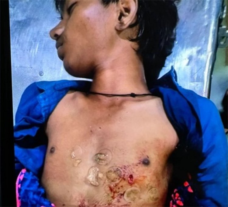 नाबालिग ने दोस्त की छाती में घुसा दी लोहे की रॉड, मौत