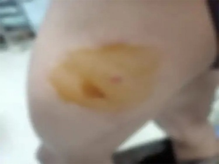 जेल में दोस्त मिलने नहीं आया, नाराज होकर मारा कैंची