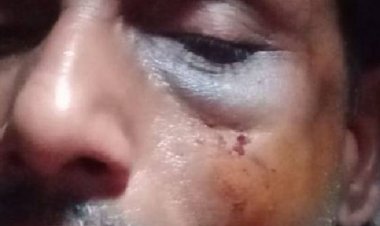 कानपुर में SHO ने हेल्पर को घूसा मारकर जबड़ा तोड़ा:नवीननगर सबस्टेशन पर गांजा फूंकन से रोका था, जमीन में गिराकर पीटा