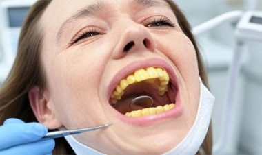 खूबसूरत मुस्कान किसी का भी दिल जीत लेती है, दांतों में जमा पीली गंदगी निकालने के लिए अपनाएं ये नुस्खे