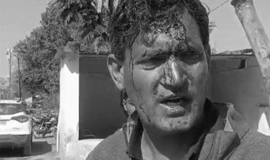 मतदान के बीच प्रत्याशी का फोड़ा सिर