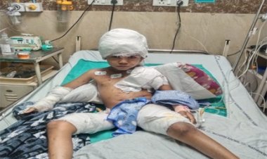 रायपुर में 6 साल के बच्चे पर कुत्तों का हमला