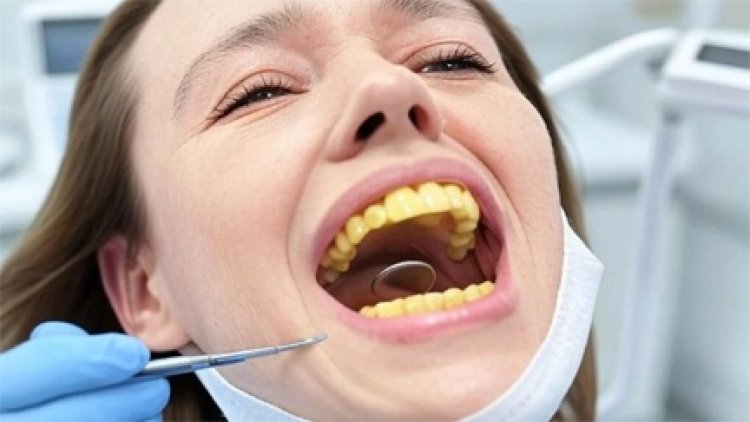 खूबसूरत मुस्कान किसी का भी दिल जीत लेती है, दांतों में जमा पीली गंदगी निकालने के लिए अपनाएं ये नुस्खे