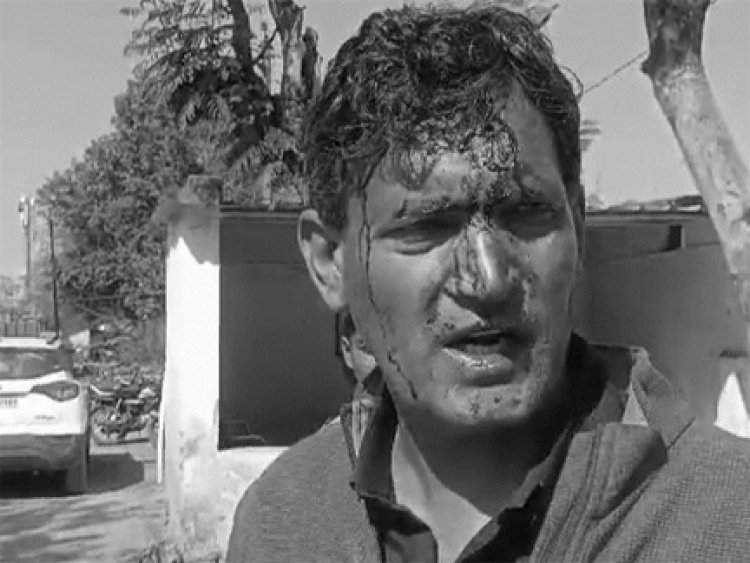 मतदान के बीच प्रत्याशी का फोड़ा सिर
