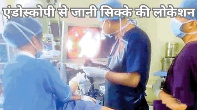 डीकेएस अस्पताल के डॉक्टरों की टीम ने बच्चे की आहार नली से बिना ऑपरेशन निकाला सिक्का