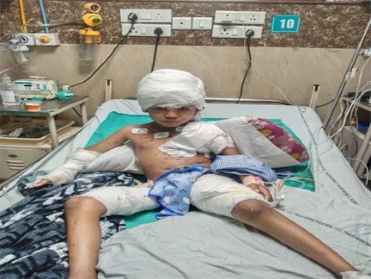 रायपुर में 6 साल के बच्चे पर कुत्तों का हमला