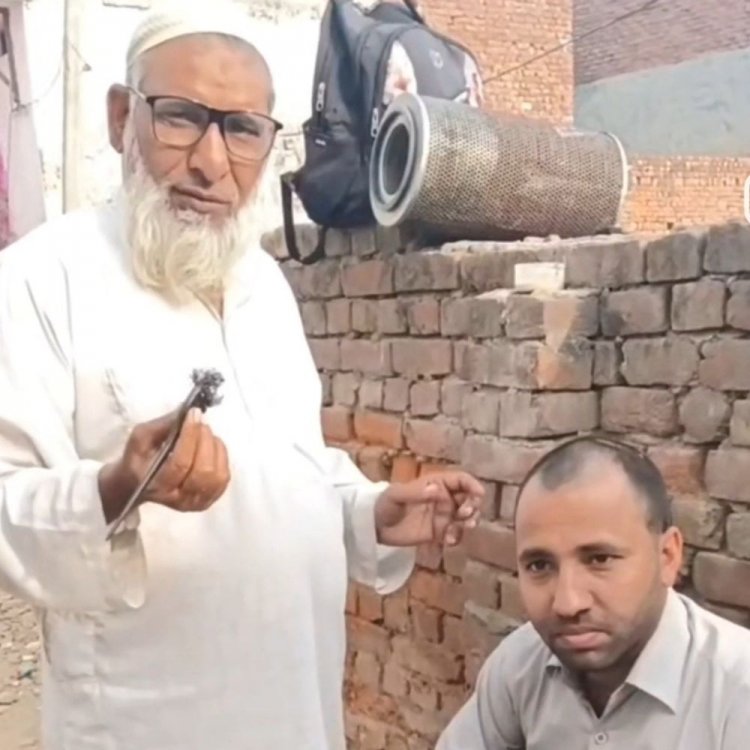 मेरठ में बाल उगाने का एक और फर्जी दावा:यासीन ने कहा- तीन मालिश में आएंगे बाल, पुलिस करेगी कार्रवाई