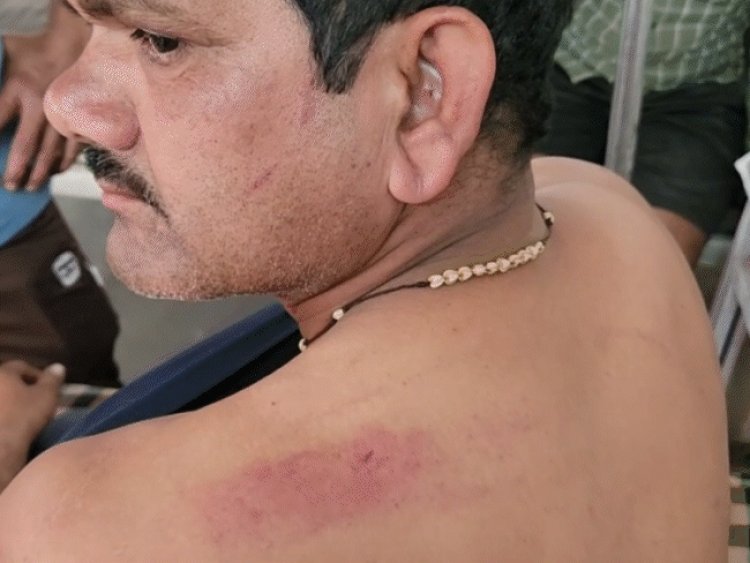 छतरपुर में कार-बाइक की टक्कर के बाद मारपीट:8 लोगों ने 2 युवकों को बेल्ट और डंडों से पीटा; 10 हजार और मोबाइल लूटे