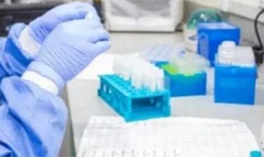 नाइजीरिया में लासा बुखार महामारी से मरने वालों की संख्या बढ़कर 127 हुई