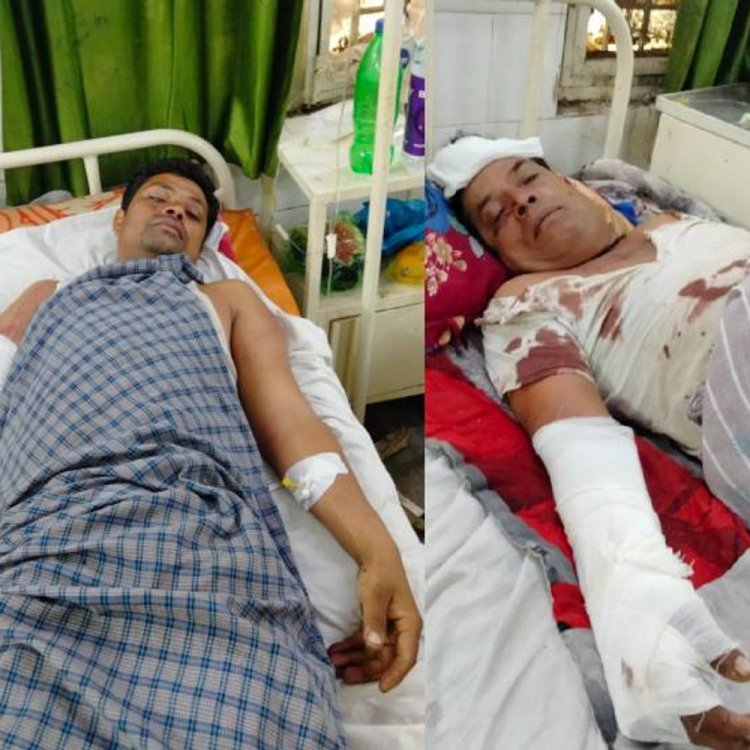 नकाबपोश बदमाशों ने देर रात पिता-पुत्र को पीटा:घर में घुसकर की मारपीट, हाथ-पैर में फ्रैक्चर; रुपयों के लेनदेन का मामला