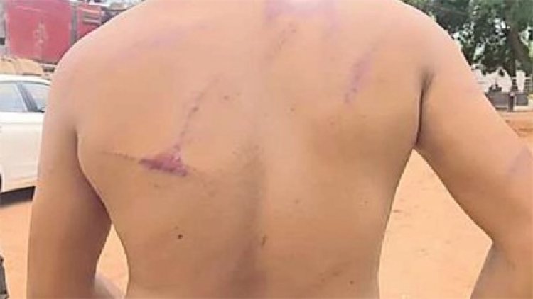 वन विभाग की टीम पर हमला, डिप्टी रेंजर समेत पांच लोग घायल