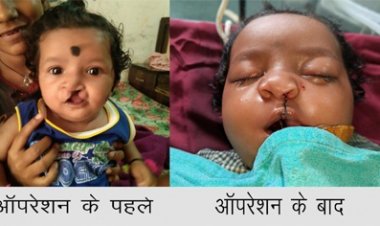 चिरायु योजना ने लौटाई मासूमों की मुस्कान