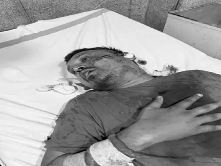 जेल में बंद कांग्रेस नेता आशिष शिंदे पर हमला