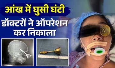 9 वर्षीय मासूम के आंख से होते हुए दिमाग में घुसी घंटी, डॉक्टरों ने ऑपरेशन कर निकाला