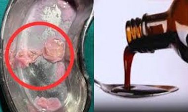 सीरप की बोतल में संदिग्ध वस्तु मिलने का मामला, जांच के लिए नमूने को भेजा गया राज्य औषधि परीक्षण प्रयोगशाला