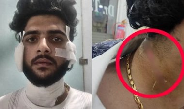 यश शर्मा हत्याकांड के मुख्य गवाह पर जानलेवा हमला