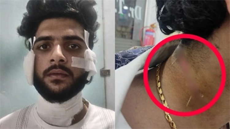 यश शर्मा हत्याकांड के मुख्य गवाह पर जानलेवा हमला