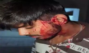 राजधानी रायपुर में वारदात: प्रॉपर्टी डीलर के बेटे को मारा चाकू