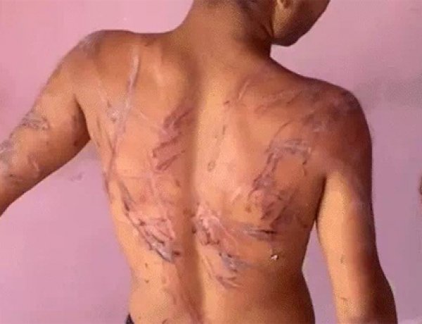 VIDEO वायरल: रायपुर में युवक को क्रूरता से पीटा और घायल किया गया