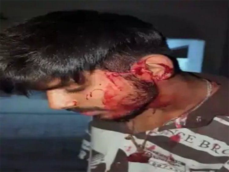 राजधानी रायपुर में वारदात: प्रॉपर्टी डीलर के बेटे को मारा चाकू