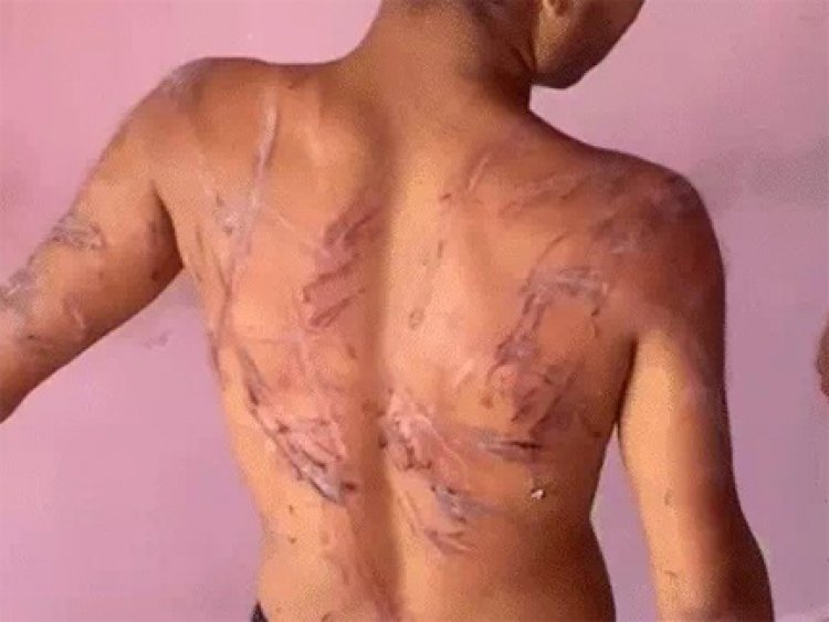 VIDEO वायरल: रायपुर में युवक को क्रूरता से पीटा और घायल किया गया