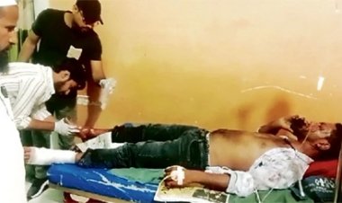 दुकान में AC कंप्रेशर फटा, बिलासपुर में दो भाई ब्लास्ट में आए