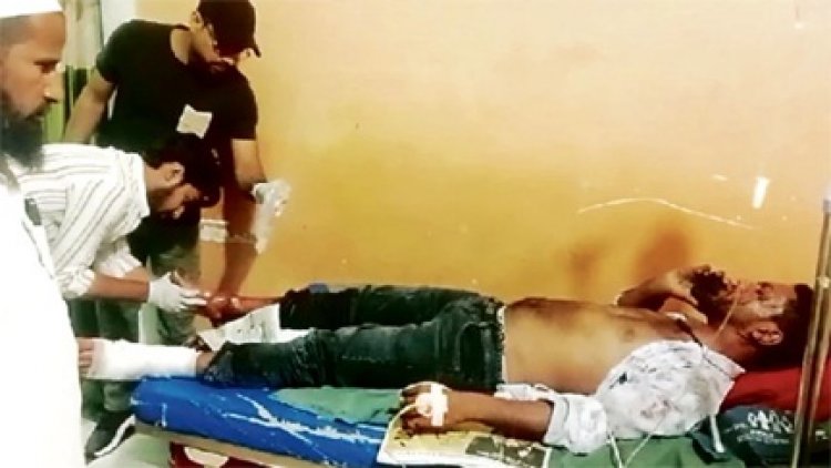 दुकान में AC कंप्रेशर फटा, बिलासपुर में दो भाई ब्लास्ट में आए