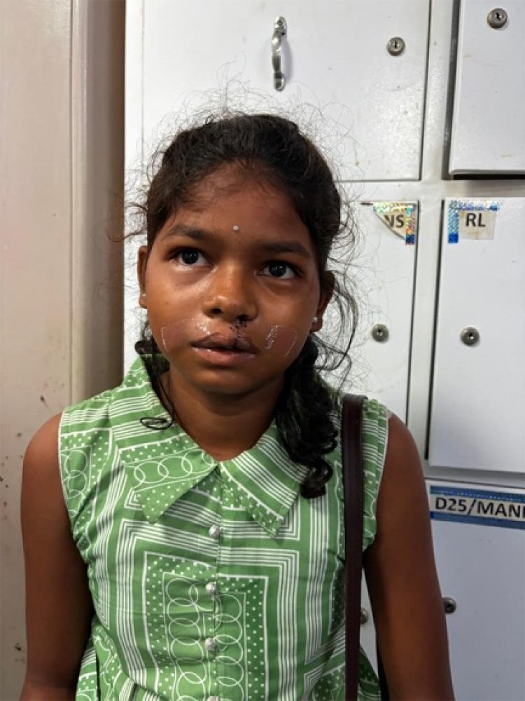 कटे होंठ से टूटी हिम्मत तक… एक ऑपरेशन और बदल गई जिंदगी