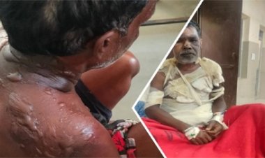 पत्नी की महुआ शराब बिक्री पर पति नाखुश, विवाद में उड़ाई गर्म माढ़