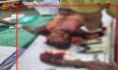 चलती ट्रेन की चपेट में आया युवक, हाथ कटकर अलग