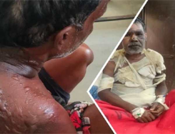 पत्नी की महुआ शराब बिक्री पर पति नाखुश, विवाद में उड़ाई गर्म माढ़