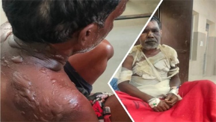 पत्नी की महुआ शराब बिक्री पर पति नाखुश, विवाद में उड़ाई गर्म माढ़