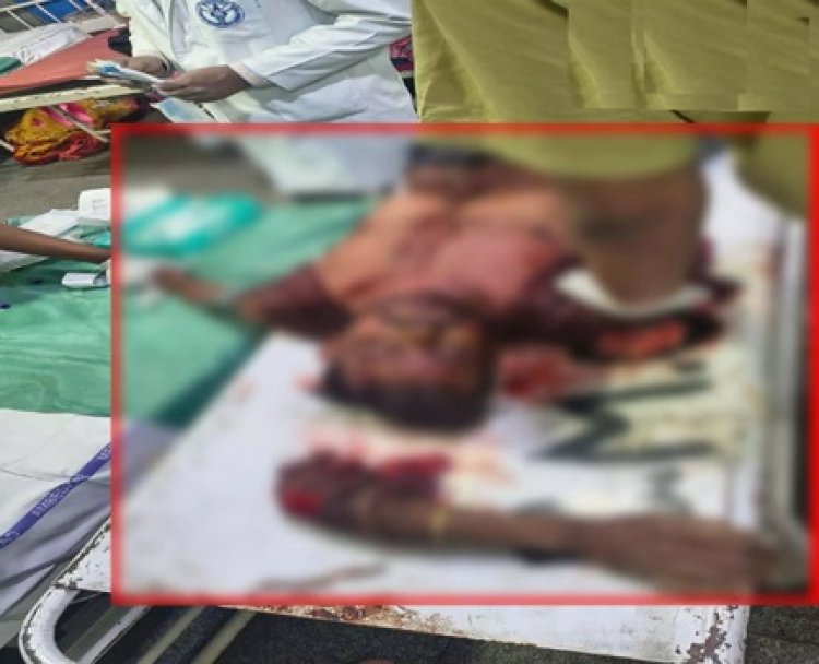 चलती ट्रेन की चपेट में आया युवक, हाथ कटकर अलग