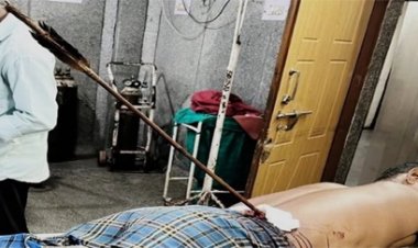 आंबेडकर अस्पताल में सफल जटिल सर्जरी