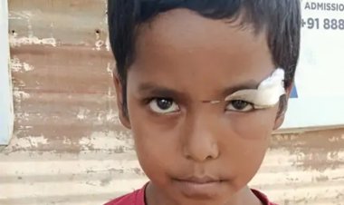 सीलिंग फैन गिरने से छात्र की आंख में गंभीर चोट