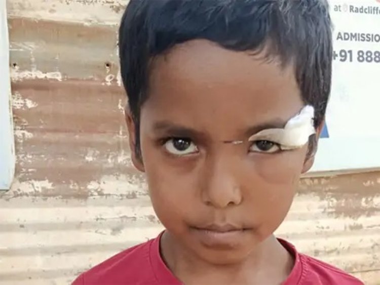 सीलिंग फैन गिरने से छात्र की आंख में गंभीर चोट