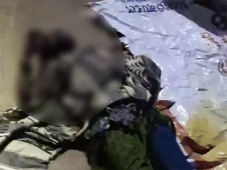 रायपुर में बॉयफ्रेंड ने प्रेमिका को जलाया